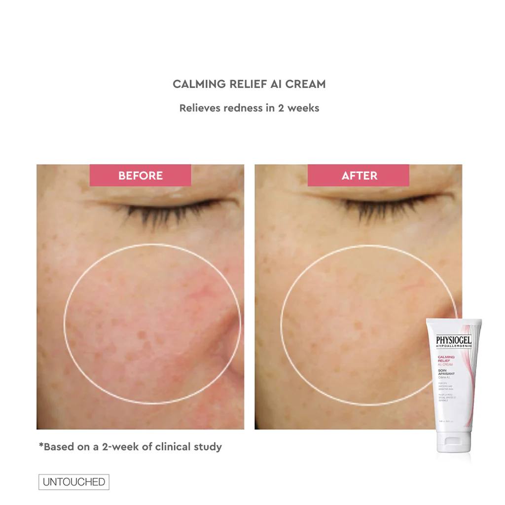 Physiogel Calming Relief A.I. Cream 100ml (For Dry, Irritated & Sensitive Skin)